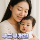내가 누구개? | 구순구개열수술을 언청이수술 이라고 부르게 된 이유