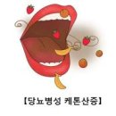 당뇨병성 케톤산증 원인1형 당뇨 합병증 이미지