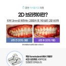 투디(2D)치과의원 네이버블로그