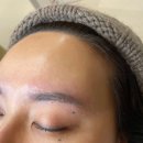 모해윤 | 용인 기흥 동백 모해윤 눈썹문신제거 받은 리얼후기
