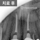 종로크라운 이미지