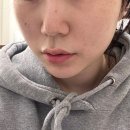 마스터메디 | 노원 피부관리 바디관리 셀루닉하우스 강북점 메디스파 마스터v9 후기