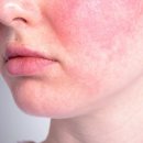 비바덤의원 이미지