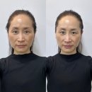 현진에버빌여자경로당 | 청주 윤곽관리 맛집 &#34; 뷰앤비클럽왁싱 &#34; 청주산남점에서 리프팅 제대로하기