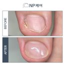 엔피케어대전