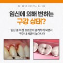 장전치과의원 | 장전동치과 임신 중 치과 치료받아도 될까요?