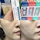 동아약국 | 동아제약 멜라토닝크림 가격 약국 사용법 3주 후기