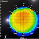 현대콘텍트안경 이미지