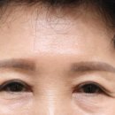 리미트성형외과의원 이미지