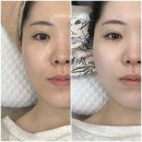 여울스킨케어 | 서면문제성피부전문 여울에스테틱 장벽케어 맞춤부스터관리 내돈내산