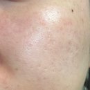 진성바이오 | 수부지 광명템 바이오힐보 판테셀 리페어 시카 크림&amp;크림미스트 사용 후기