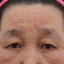 고유성형외과의원 네이버블로그