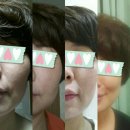 림스킨케어 이미지