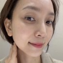 영원목욕탕 | 강남 신논현 피부과, 아쿠아필 대신 수소토닝 진행후기