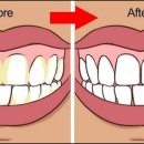 비앤비치과의원 이미지
