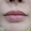 부천 신중동 검은입술케어 입술톤업 입술비대칭 교정 잘하는곳 추천 후기 라뷰티아카데미 [BiNi뷰티]