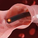 &#34;배 아픈 게 스트레스 탓?&#34;… 과민성대장증후군, 장보다 뇌 문제일수도 [인터뷰] 이미지