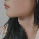 20대 여자의 관리데이! 전주 피부과 얼굴 리프팅 텐트리플 후기! 한달 후기 총정리