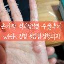 손가락 석회성건염, 방아쇠수지증 수술 후기 with 청담탑정형외과