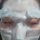 강남피부과의원 | 강남역 피부과 뉴스타의원 온다리프팅후기