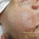 바이오메디 | 트러블 피부 진정템 추천, 바이오폭스 메디프레스 트러블쉴드 크림 솔직 후기