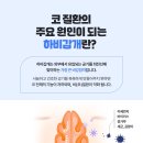 코자요03