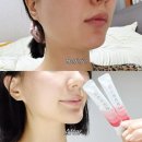 아이돌 붓기제거 뷰티템 너무 궁금해서 직접 찾은 영양제 후기!