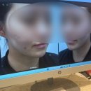 셀인 | 얼굴 피부탄력 지방분해주사 셀인아웃주사 후기