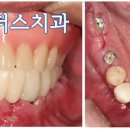 하늘치과기공소 이미지