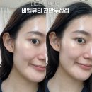 비타민뷰티샵 - 속초시 교동로 13 | 천안 비엘뷰티 비타민 미백관리(이온토) + LDM 후기