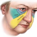 이 동 | 강남팔자주름 필러 처짐, 이동없이 받을 수 있습니다 - 전후 시술 후기 공개