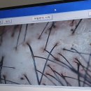 닥터모락 안성점 | [평택두피관리] 닥터모락 평택점에서 받은 두피 딥스케일링 후기