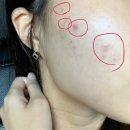 고은메디컬 | 부산 경락 윤곽관리 다이렉트 제휴 웨딩관리 결이고은 부산해운대점 내돈내산 후기