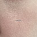 강매로 | [여신티켓 내돈내산] 홍대 피코토닝 10회 이벤트 최저가 후기(강매X 차별X): 예약, 환불