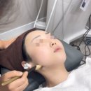 전주 데이뷰의원 첫 방문 후기,첫 방문이벤트 온다리프팅+스킨보톡스+피부관리 체험기 ✨