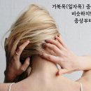 참한의원 티스토리