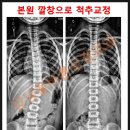 보조기나라 이미지