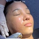 웰(WELL)성형외과의원 | K-beauty 열풍 속 주목! 줄기세포 피부재생 시술 리얼 가이드