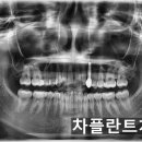태인치과의원 네이버블로그