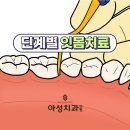 내덕동치과 잇몸아플때 치료과정