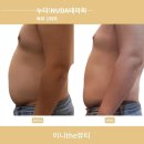 도시기억상실증 이미지