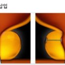 소문난비뇨의학과의원 이미지