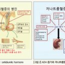 과도한 저염식으로 인해 나트륨 농도가 기준치(135mmol/L) 이하로 떨어지면 저나트륨혈증 이미지