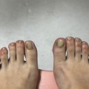 마이디피부과의원 네이버블로그