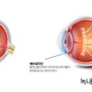 글로우안경원 이미지