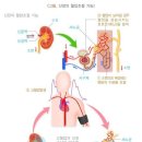 만성신장질환(3,4,5기) 분류표[별표-질병관련25] 이미지