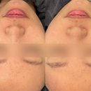 드림빌딩 | 명지피부관리 올가드림뷰티 명지점 모공디톡스 후기