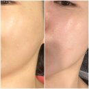 명륜로129번길 | 부산 동래피부관리 끝판왕 동안에스테틱 스킨쫀짠관리 모공관리 후기