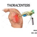 천자로-2 이미지