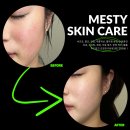 메스티(MESTY) 네이버블로그